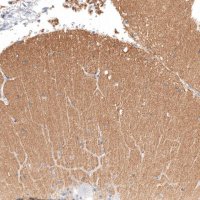Anti-IGSF21 antibody produced in rabbit HPA044535-100UL
