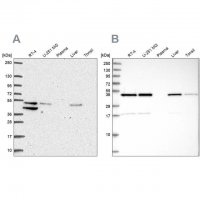 Anti-IKBIP antibody produced in rabbit 