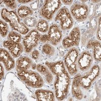 Anti-IL22RA2 antibody produced in rabbit 