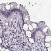 Anti-IMPG1 antibody produced in rabbit 