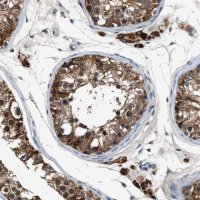 Anti-INHA antibody produced in rabbit 