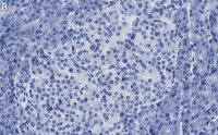 Anti-Insulin Antibody, clone 3B5 ZooMAb Rabbit Monoclonal 