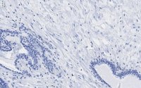 Anti-Integrin beta 1 Antibody, clone HUTS-4 ZooMAb Mouse Monoclonal 
