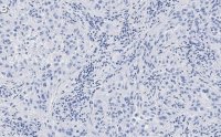Anti-Integrin V3 Antibody, clone EM22703 ZooMAb Rabbit Monoclonal 
