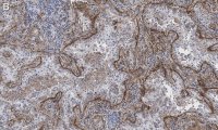 Anti-Integrin V5 Antibody, clone EM09902 , ZooMAb Rabbit Monoclonal 