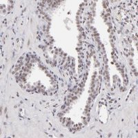 Anti-INTS6 antibody produced in rabbit 