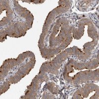 Anti-IQCK antibody produced in rabbit HPA026792-100UL