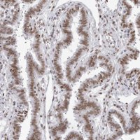 Anti-IRF2BP2 antibody produced in rabbit 