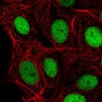Anti-IRF2BPL antibody produced in rabbit 