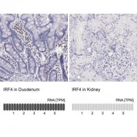 Anti-IRF4 antibody produced in rabbit 