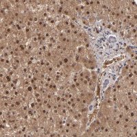 Anti-ITIH4 antibody produced in rabbit 