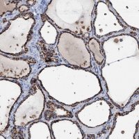 Anti-IVD antibody produced in rabbit HPA041391-100UL