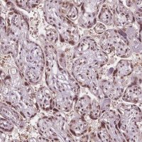 Anti-IWS1 antibody produced in rabbit 