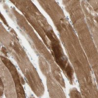 Anti-JPH1 antibody produced in rabbit 