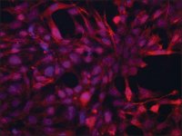 Anti-JUB (N-terminal) antibody produced in rabbit 