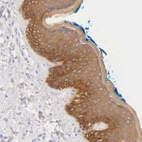 Anti-JUP antibody produced in rabbit 
