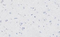 Anti-K+/Cl- Cotransporter-2 Antibody, clone 5E13 ZooMAb Rabbit Monoclonal 