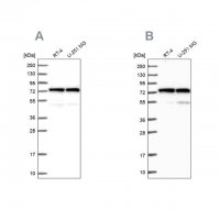 Anti-KARS antibody produced in rabbit 