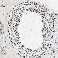Anti-KAT6B antibody produced in rabbit 