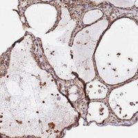 Anti-KATNAL2 antibody produced in rabbit 