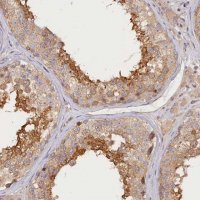 Anti-KATNB1 antibody produced in rabbit 