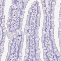 Anti-KCNC1 antibody produced in rabbit 