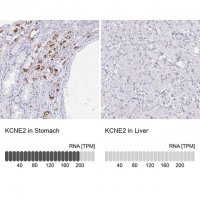 Anti-KCNE2 antibody produced in rabbit 