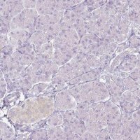 Anti-KCNH1 antibody produced in rabbit 