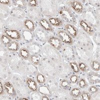 Anti-KCNJ1 antibody produced in rabbit 