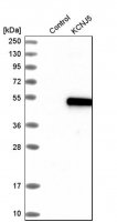 Anti-KCNJ5 antibody produced in rabbit HPA017353-100UL