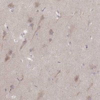 Anti-KCNJ9 antibody produced in rabbit 