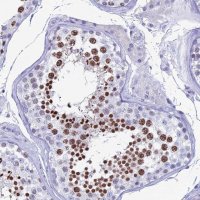 Anti-KCNK17 antibody produced in rabbit HPA043892-100UL