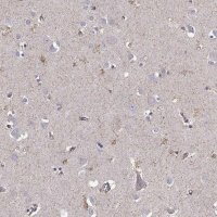 Anti-KCNMB4 antibody produced in rabbit 