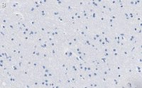 Anti-KCNQ2 Antibody, clone 2G18 ZooMAb Rabbit Monoclonal 
