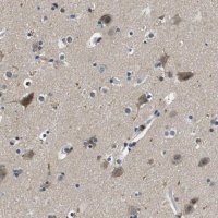 Anti-KCNQ5 antibody produced in rabbit 