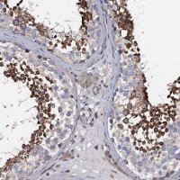 Anti-KCTD4 antibody produced in rabbit 