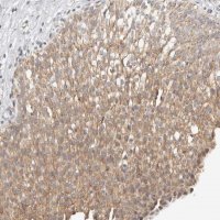 Anti-KDF1 antibody produced in rabbit 