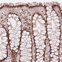 Anti-KDM5B antibody produced in rabbit 