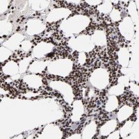 ANTI-KDM6A antibody produced in rabbit 