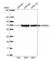 Anti-KHDRBS1 antibody produced in rabbit 