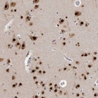 Anti-KHDRBS2 antibody produced in rabbit 