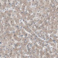 Anti-KHK antibody produced in rabbit HPA007040-100UL