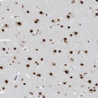 Anti-KHSRP antibody produced in rabbit 