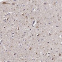 Anti-KIAA0319 antibody produced in rabbit 