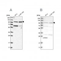 Anti-KIAA0753 antibody produced in rabbit 