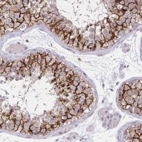 Anti-KIAA1210 antibody produced in rabbit 
