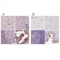 Anti-KIAA1324 antibody produced in rabbit 