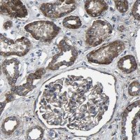 Anti-KIAA1958 antibody produced in rabbit 