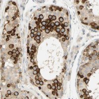 Anti-KIF11 antibody produced in rabbit 