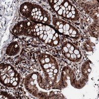 Anti-KIF18A antibody produced in rabbit 